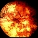 Choroidal atrophy Choroidal atrophy
